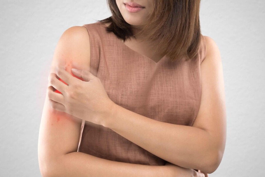 Chronic Skin Conditions
